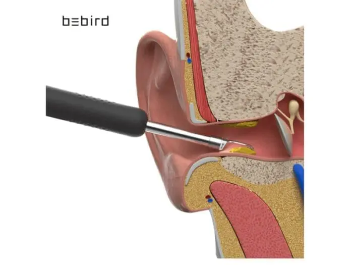 گوش پاک کن هوشمند شیائومی Bebird R1 (نسخه جدید  اورجینال _ ارسال فوری) NEW - Image 8