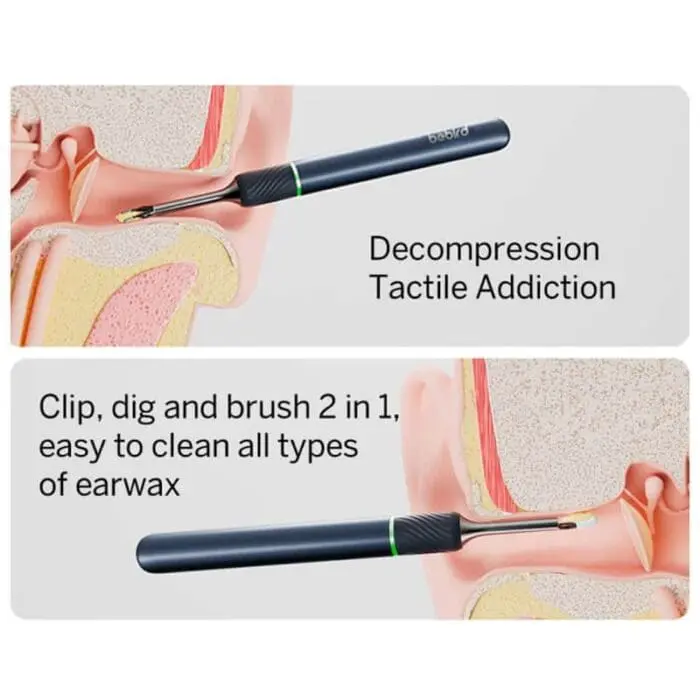 گوش پاک کن شیائومی مدل Bebird Note 5 (اورجینال پلمپ ارسال فوری) - Image 2