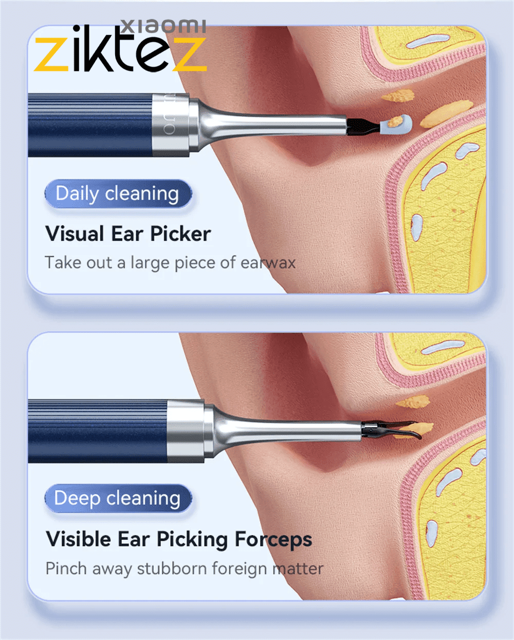 گوش پاک‌کن هوشمند حرفه ای ۴ کاره visual ear pick tweezers 10MP HD